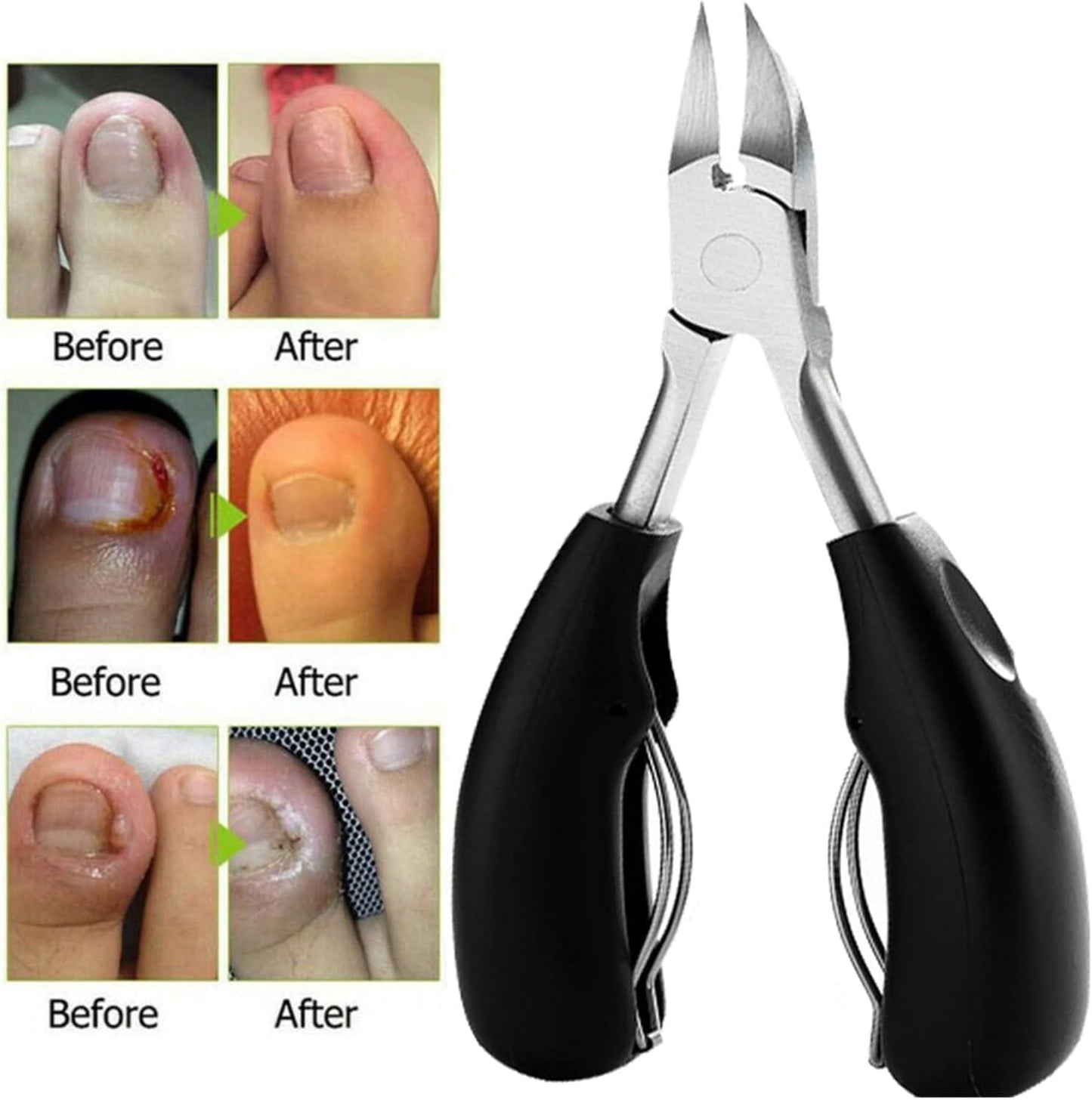Heavy Duty Toenail Clipper for Thick Nails