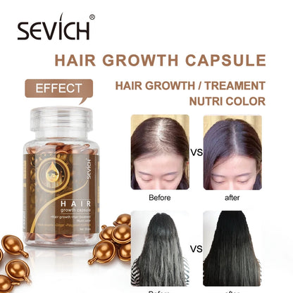Sevich Hair Serum with Polygonum Multiflorum, Ginger Hair Growth Capsules, Vitamin Oil Repair Treatment for Damaged Hair