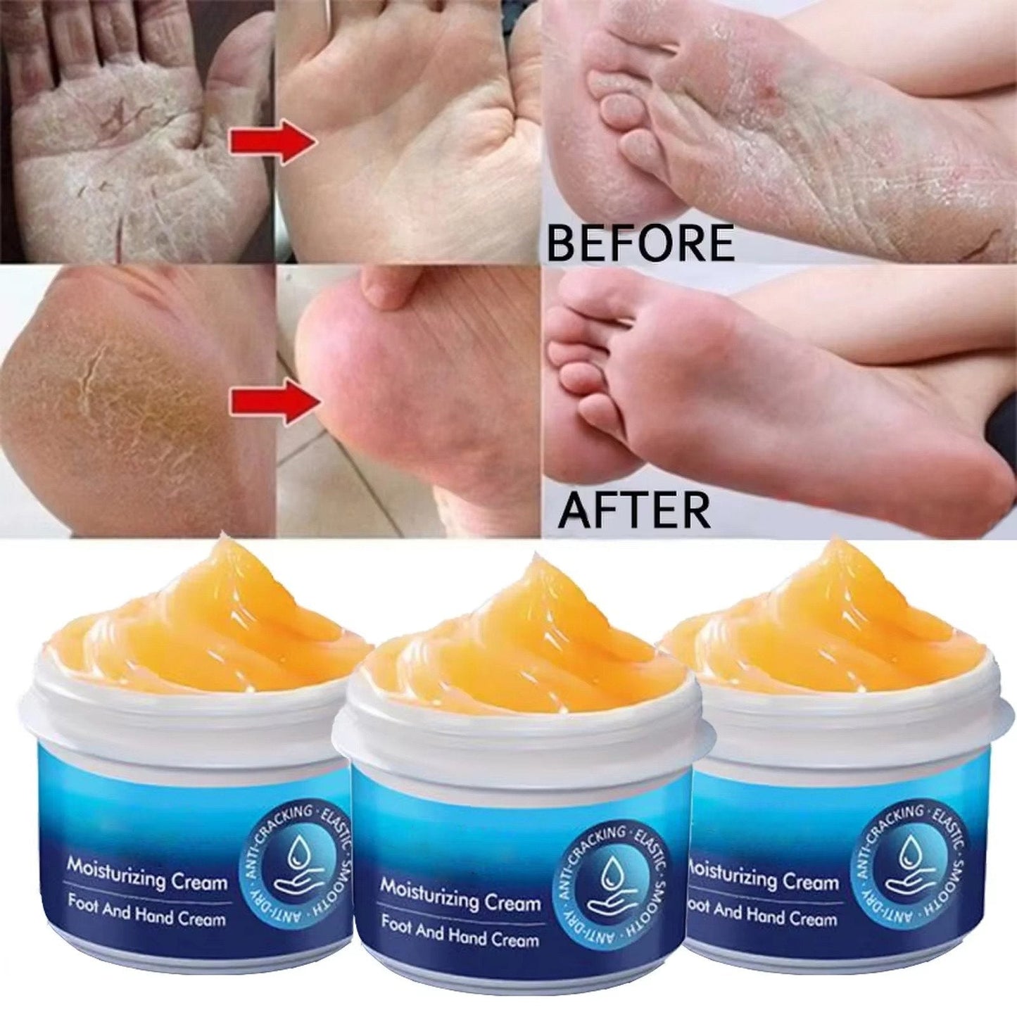 Cracked Foot Heel Treatment 3 Pack