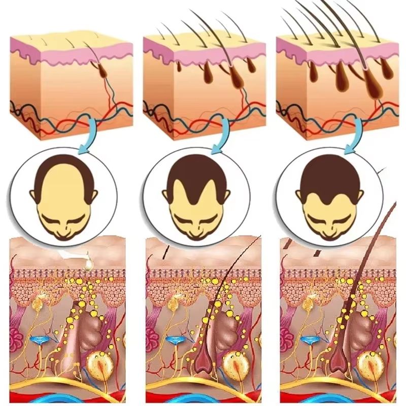 Ginger Germinal Hair Growth Serum - Intensive 7-day Root Nourish and Hair Repair Elixir