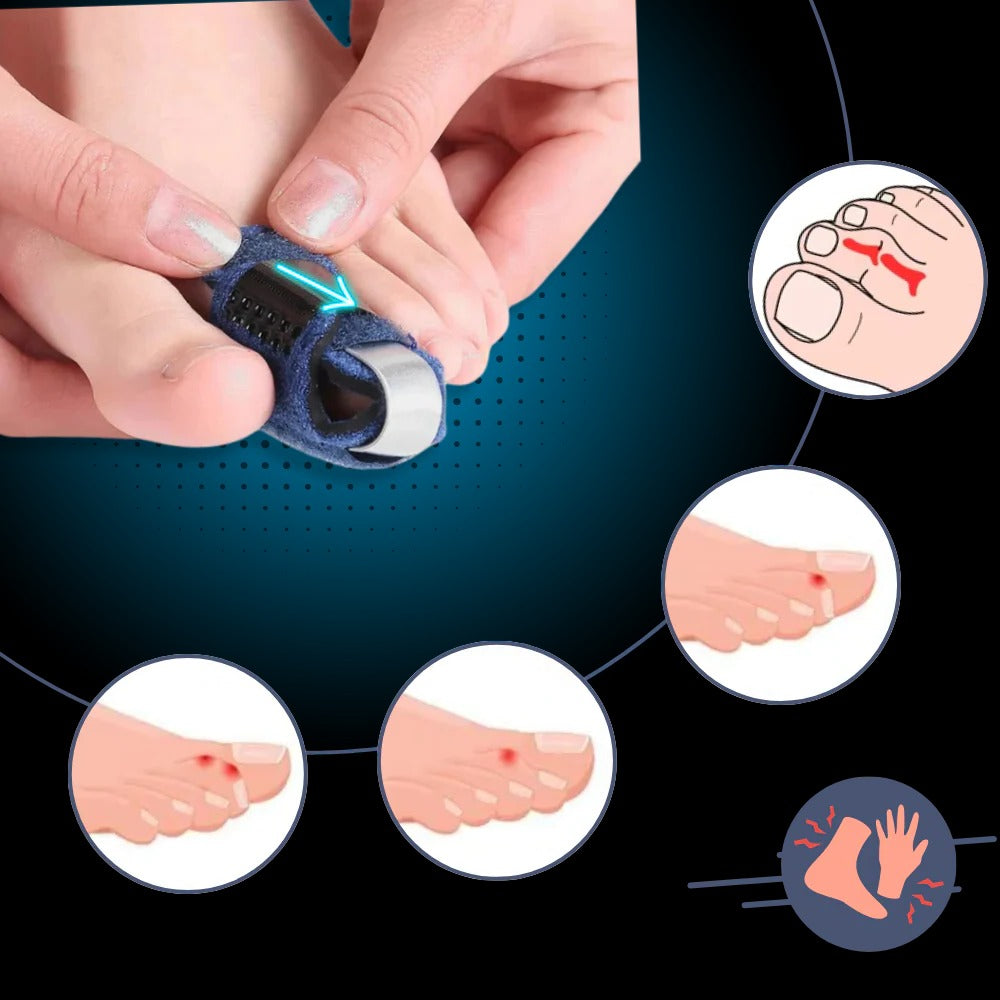 Toe Straightener with Adjustable Support